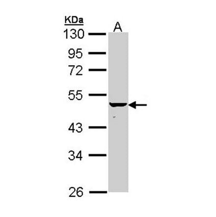 KRTHA4 antibody from Signalway Antibody (22208) - Antibodies.com