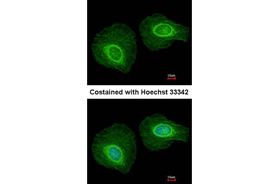 Immunofluorescence - KRTHA4 antibody from Signalway Antibody (22208) - Antibodies.com