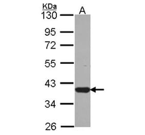 LZTFL1 antibody from Signalway Antibody (22235) - Antibodies.com