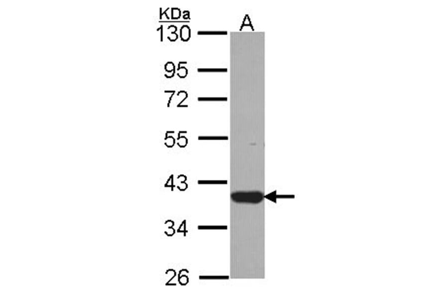LZTFL1 antibody from Signalway Antibody (22235) - Antibodies.com