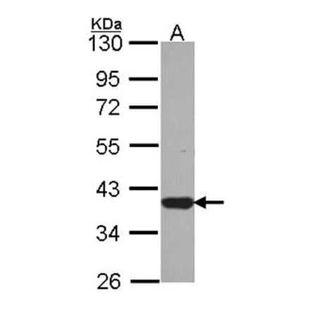 LZTFL1 antibody from Signalway Antibody (22235) - Antibodies.com