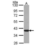 LZTFL1 antibody from Signalway Antibody (22235) - Antibodies.com