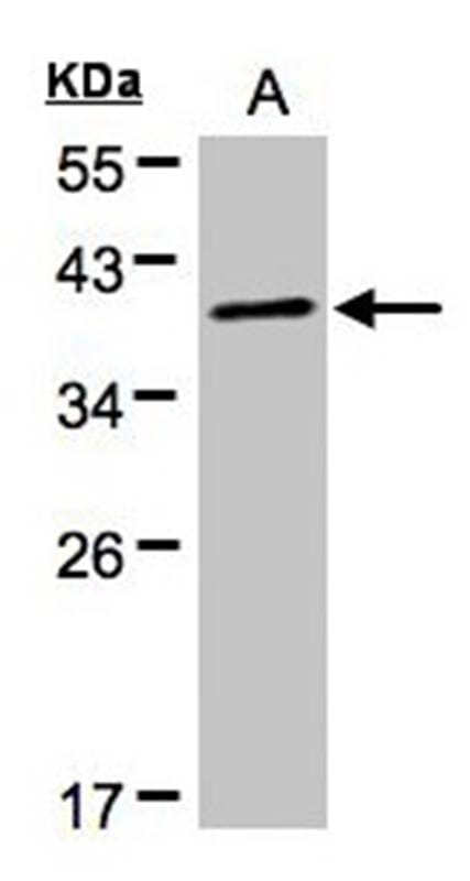 Anti-PRKACA Antibody (A39494) | Antibodies.com