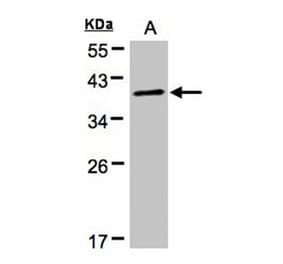 PRKACA antibody from Signalway Antibody (22276) - Antibodies.com
