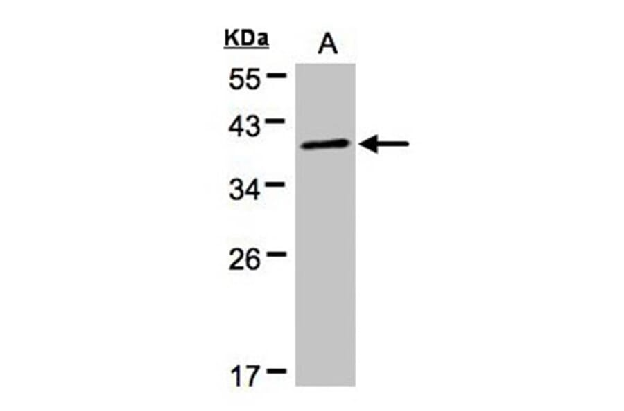 PRKACA antibody from Signalway Antibody (22276) - Antibodies.com
