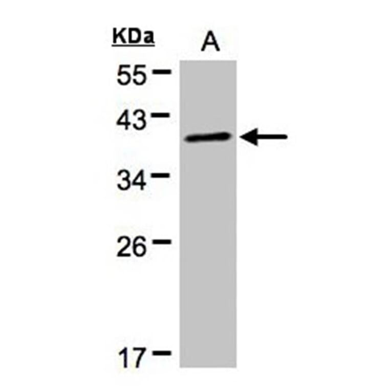 PRKACA antibody from Signalway Antibody (22276) - Antibodies.com