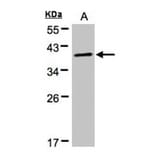 PRKACA antibody from Signalway Antibody (22276) - Antibodies.com