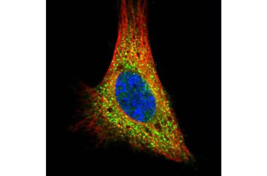 PRKACA antibody from Signalway Antibody (22276) - Antibodies.com