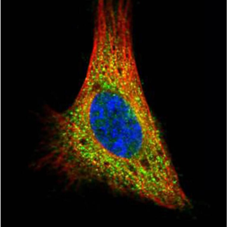 PRKACA antibody from Signalway Antibody (22276) - Antibodies.com