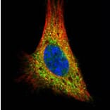 PRKACA antibody from Signalway Antibody (22276) - Antibodies.com
