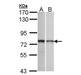 ZNF398 antibody from Signalway Antibody (22369) - Antibodies.com