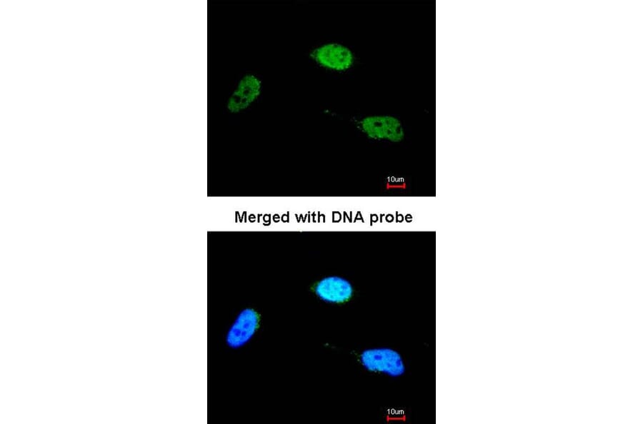 Immunofluorescence - ZNF398 antibody from Signalway Antibody (22369) - Antibodies.com