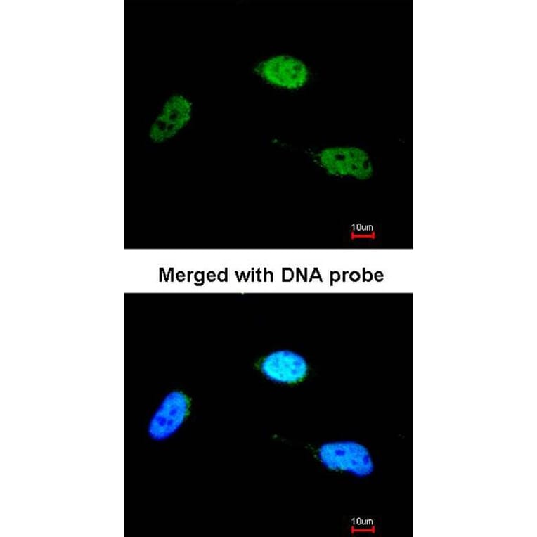 Immunofluorescence - ZNF398 antibody from Signalway Antibody (22369) - Antibodies.com