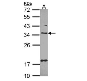 TXNDC1 antibody from Signalway Antibody (22377) - Antibodies.com