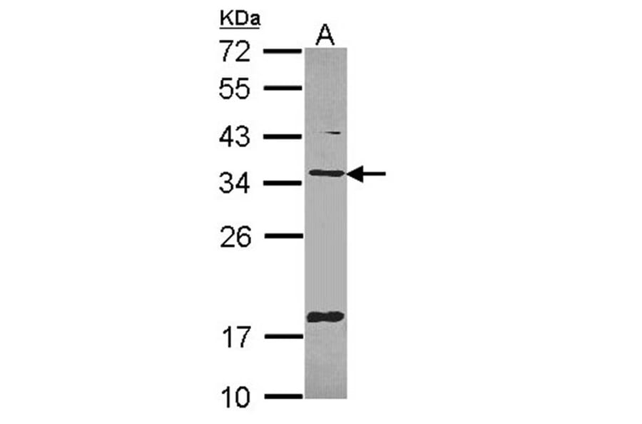 TXNDC1 antibody from Signalway Antibody (22377) - Antibodies.com