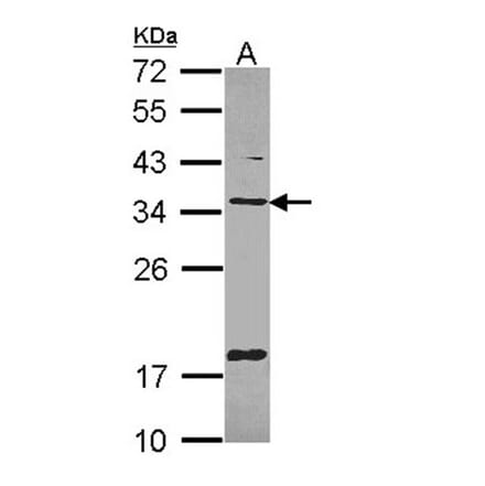 TXNDC1 antibody from Signalway Antibody (22377) - Antibodies.com