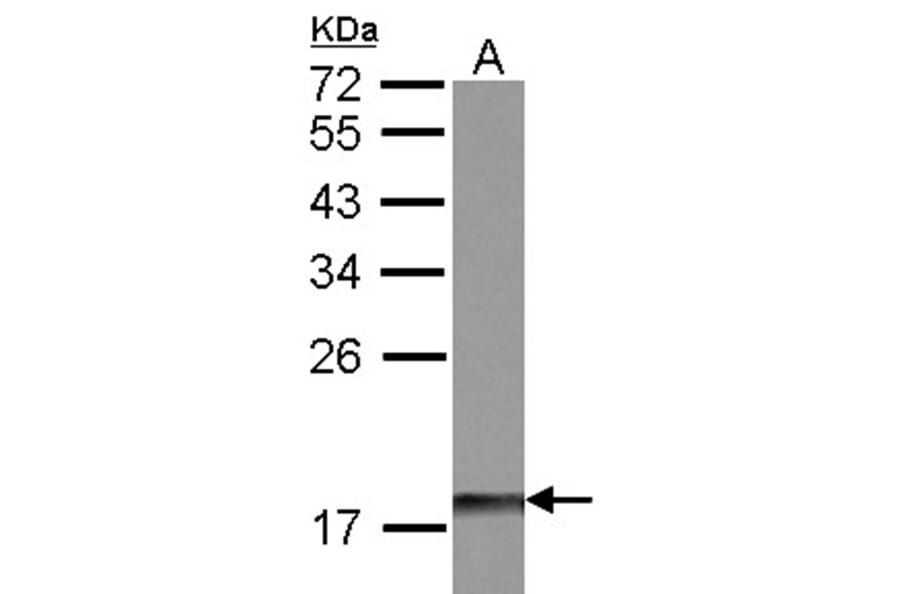 DUSP26 antibody from Signalway Antibody (22422) - Antibodies.com