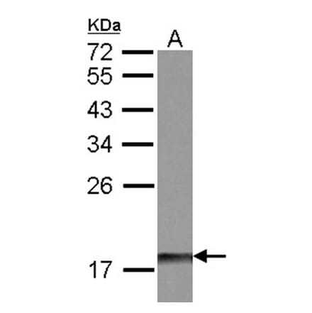 DUSP26 antibody from Signalway Antibody (22422) - Antibodies.com