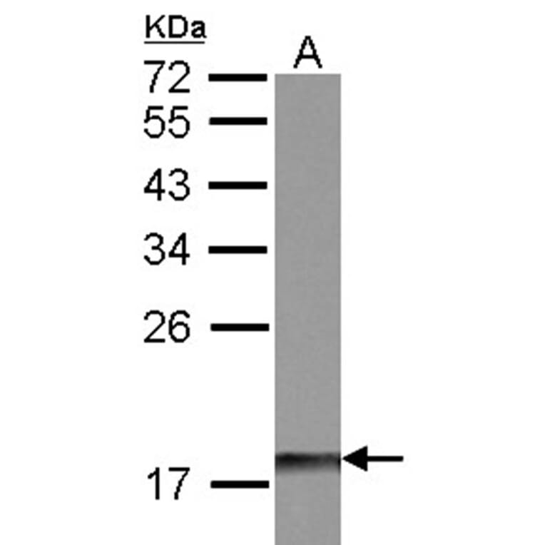 DUSP26 antibody from Signalway Antibody (22422) - Antibodies.com