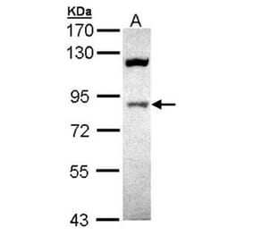 ACAP1 antibody from Signalway Antibody (22446) - Antibodies.com