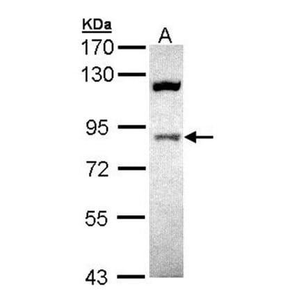 ACAP1 antibody from Signalway Antibody (22446) - Antibodies.com