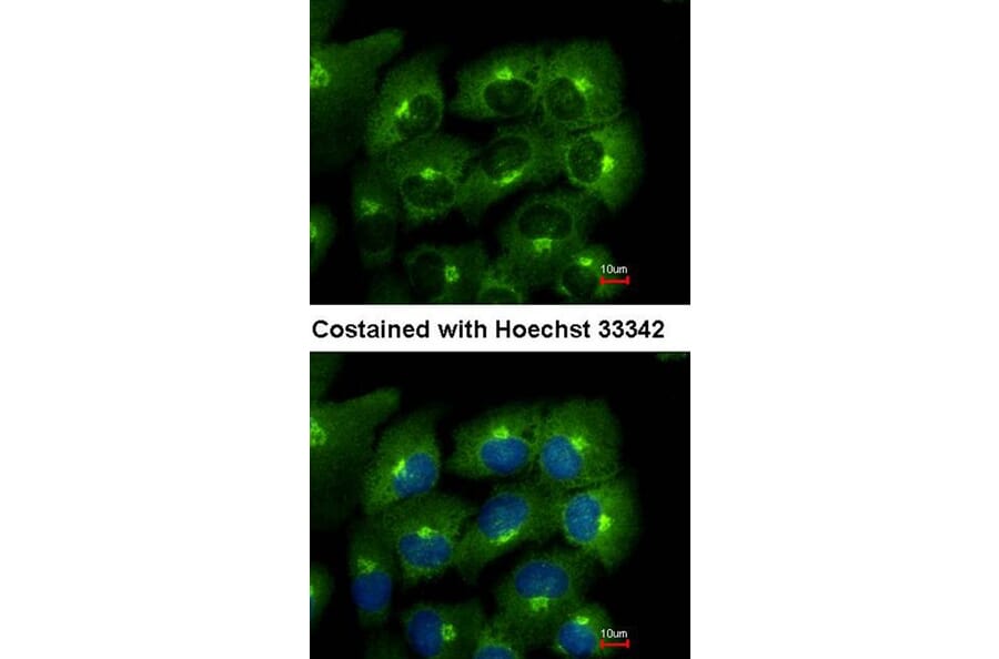 Immunofluorescence - ACAP1 antibody from Signalway Antibody (22446) - Antibodies.com