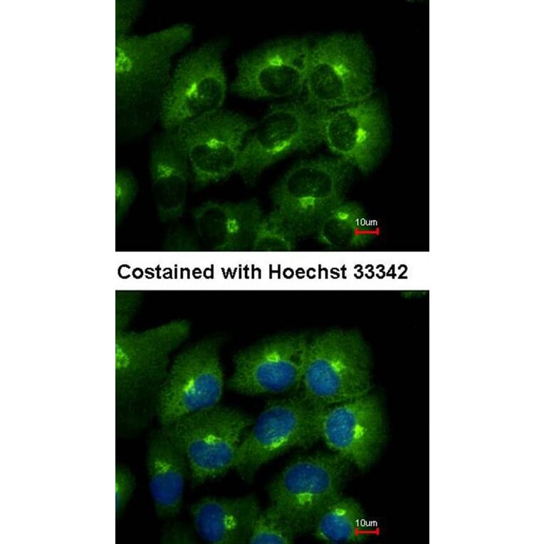 Immunofluorescence - ACAP1 antibody from Signalway Antibody (22446) - Antibodies.com