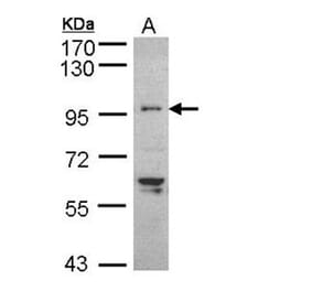 TNNI3K antibody from Signalway Antibody (22517) - Antibodies.com