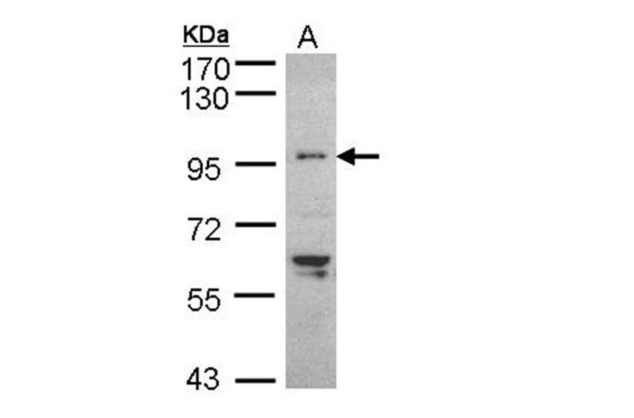 TNNI3K antibody from Signalway Antibody (22517) - Antibodies.com