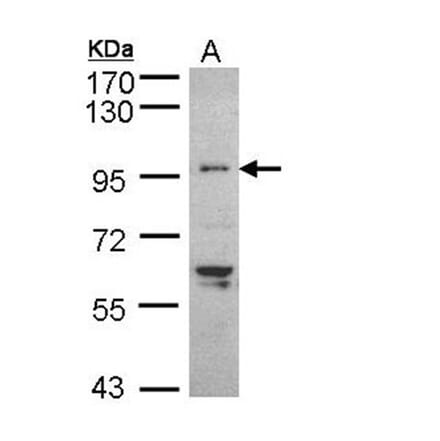 TNNI3K antibody from Signalway Antibody (22517) - Antibodies.com