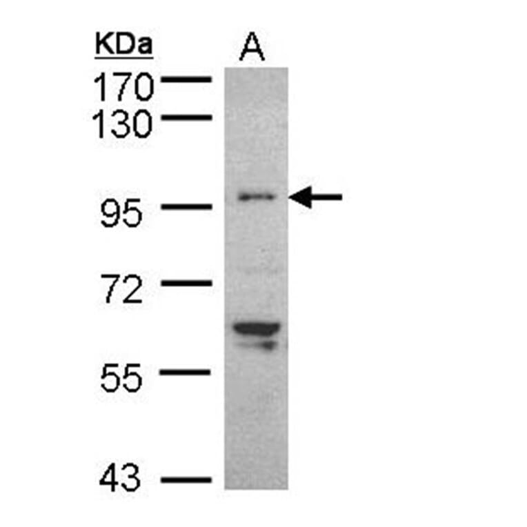 TNNI3K antibody from Signalway Antibody (22517) - Antibodies.com