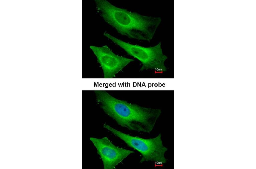 Immunofluorescence - TNNI3K antibody from Signalway Antibody (22517) - Antibodies.com