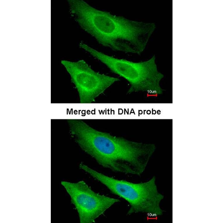 Immunofluorescence - TNNI3K antibody from Signalway Antibody (22517) - Antibodies.com