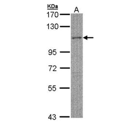 MYBPC2 antibody from Signalway Antibody (22530) - Antibodies.com