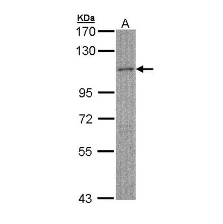 MYBPC2 antibody from Signalway Antibody (22530) - Antibodies.com