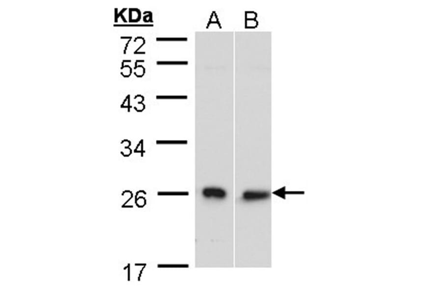 DNAJB6 antibody from Signalway Antibody (22547) - Antibodies.com