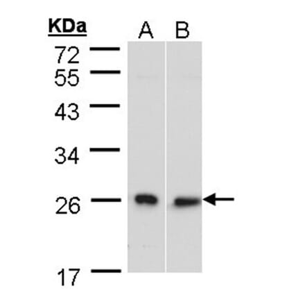 DNAJB6 antibody from Signalway Antibody (22547) - Antibodies.com