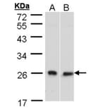 DNAJB6 antibody from Signalway Antibody (22547) - Antibodies.com
