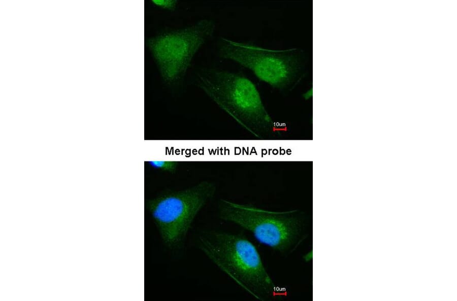 Immunofluorescence - DNAJB6 antibody from Signalway Antibody (22547) - Antibodies.com