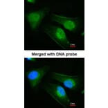 Immunofluorescence - DNAJB6 antibody from Signalway Antibody (22547) - Antibodies.com