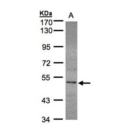 SEPHS2 antibody from Signalway Antibody (22548) - Antibodies.com