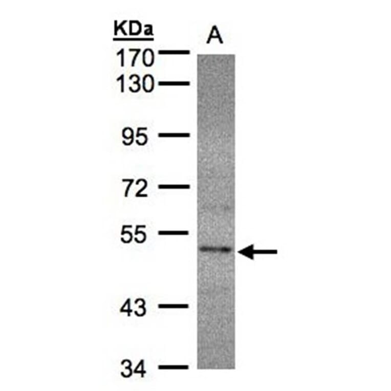SEPHS2 antibody from Signalway Antibody (22548) - Antibodies.com