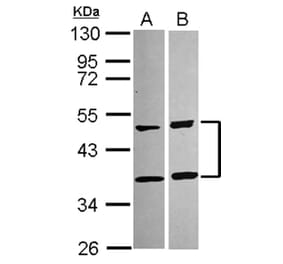 SQSTM1 antibody from Signalway Antibody (22618) - Antibodies.com