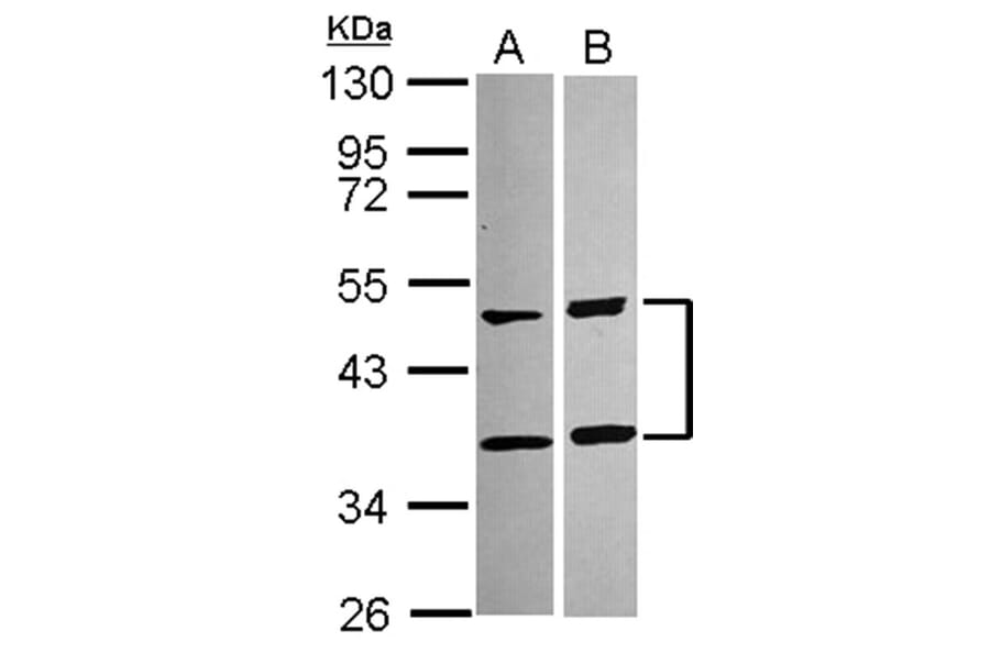 SQSTM1 antibody from Signalway Antibody (22618) - Antibodies.com