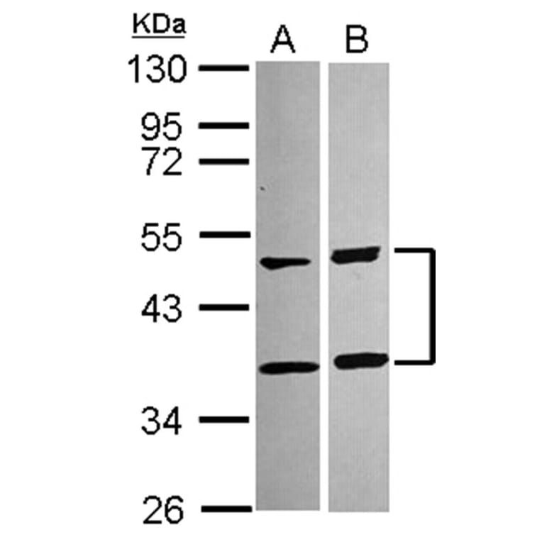 SQSTM1 antibody from Signalway Antibody (22618) - Antibodies.com