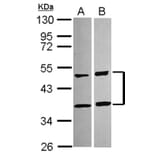 SQSTM1 antibody from Signalway Antibody (22618) - Antibodies.com