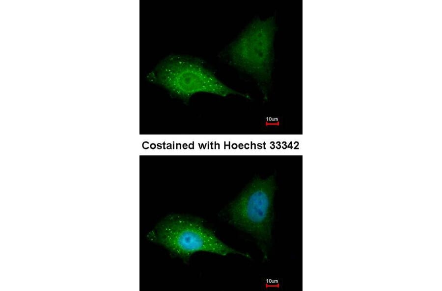 Immunofluorescence - SQSTM1 antibody from Signalway Antibody (22618) - Antibodies.com