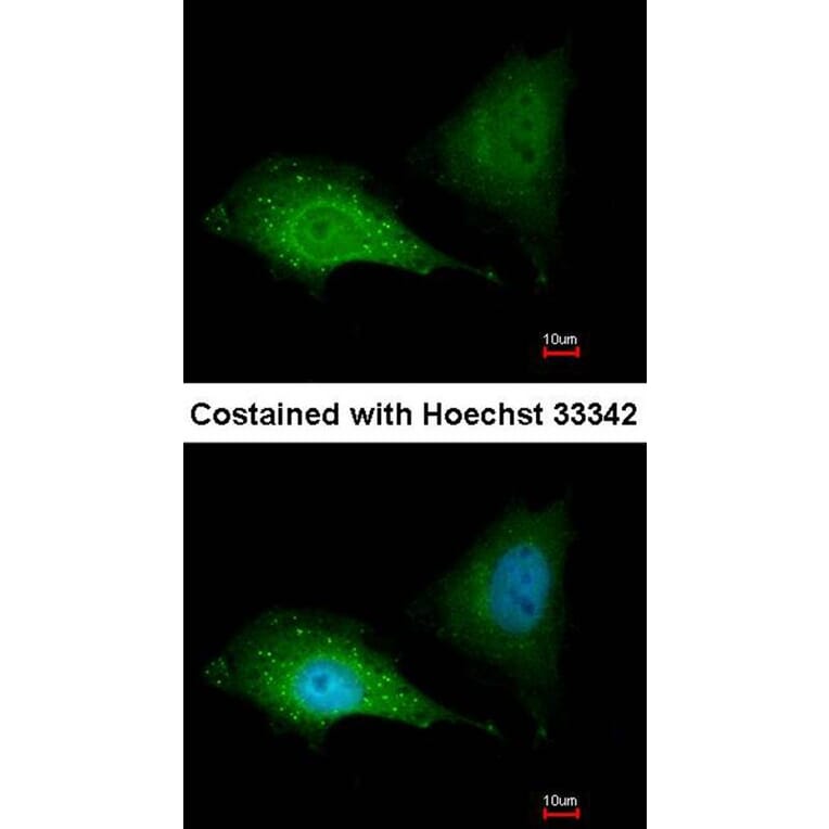 Immunofluorescence - SQSTM1 antibody from Signalway Antibody (22618) - Antibodies.com