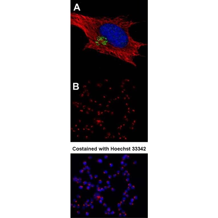 GOLPH2 antibody from Signalway Antibody (22764) - Antibodies.com