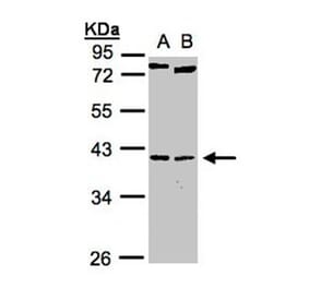 NKX2-5 antibody from Signalway Antibody (22771) - Antibodies.com